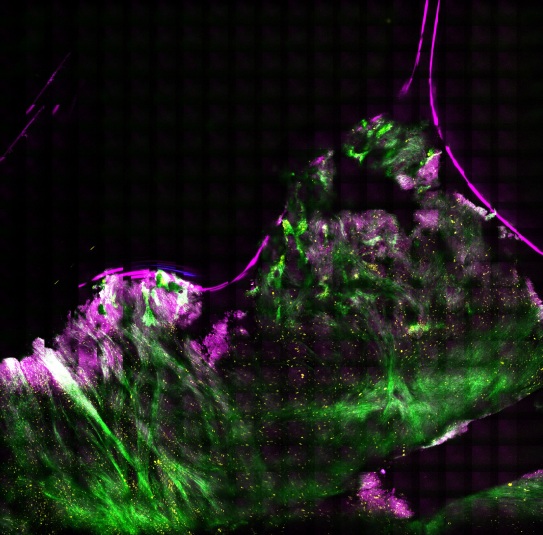 Enhancing Real-Time Histopathology with the VINCI-1064: A Case Study Featuring Eleuthra Photonics’ TetraQuant™